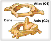 Schaubild Atlasknochen